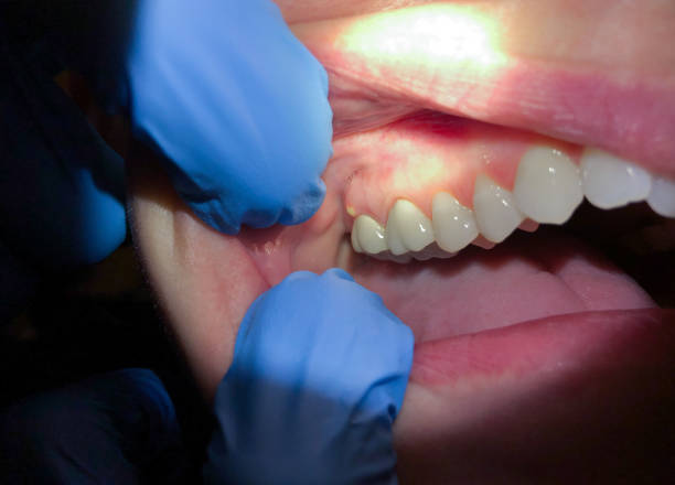 Best Emergency Treatment for Jaw Pain or Injury in Cherry Grove, OH